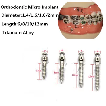 2 елемента Зъбни мини-импланти, микровинтов, отвертки за импланти от титанова сплав, Гаечен ключ за самостоятелно пробиване 1.4/1.6/1.8/2.0 мм